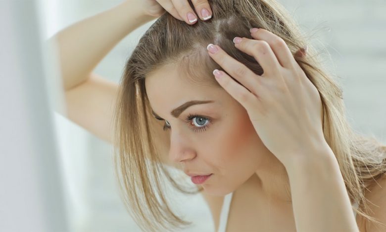 Here’s How Your Hair Problems Are A Mirror For Your Overall Health