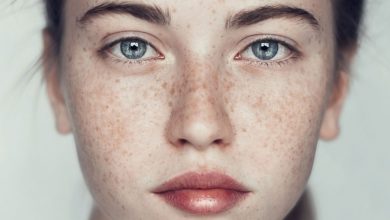 Remove Freckles And Pigmentation